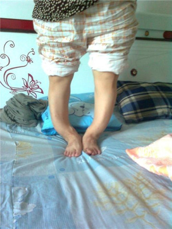 罗圈腿6.jpg