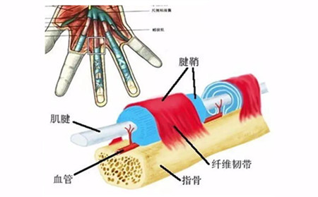 腱鞘炎.jpg